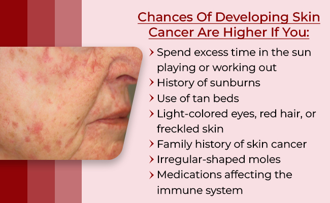 Facial Skin Cancer