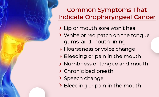 Oropharyngeal Cancer