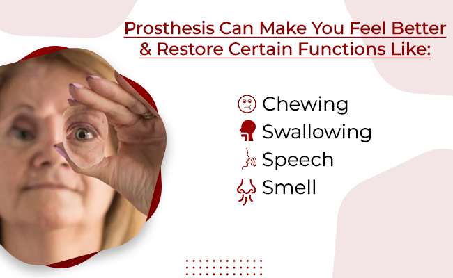 Prosthetic Rehabilitation