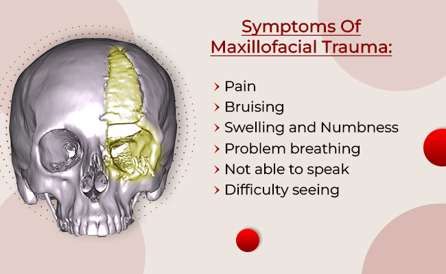 Maxillofacial Trauma
